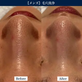 【メンズ脱毛・美肌】 SARA 恵比寿店のエステ・リラクイメージ