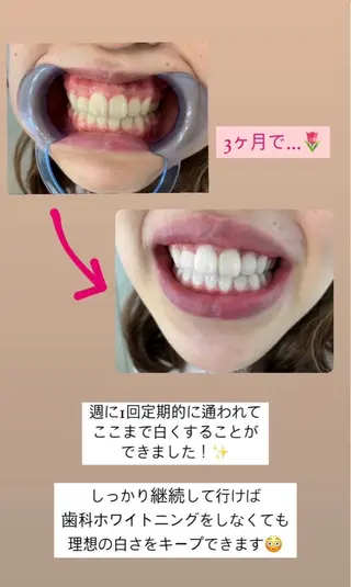 エクシアホワイト 立川南口のエステ・リラクイメージ