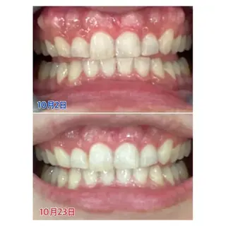 M渋谷店所属・M渋谷 ホワイトニングのエステ・リラクイメージ