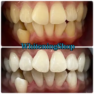 ホワイトニング ショップ吉祥寺店のエステ・リラクイメージ