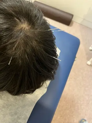 【鍼灸サロン　にった】所属・はりきゅう整体 新田鍼灸院のエステ・リラクイメージ