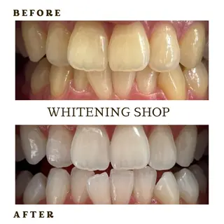 メンズ ホワイトニング ショップ葛西店のその他イメージ