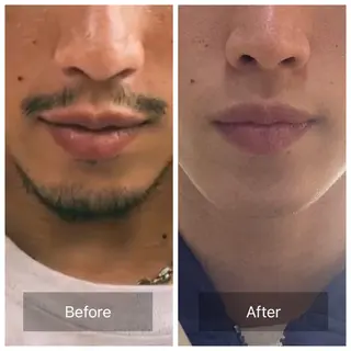 首肩こり　目の疲れ/ rieのエステ・リラクイメージ