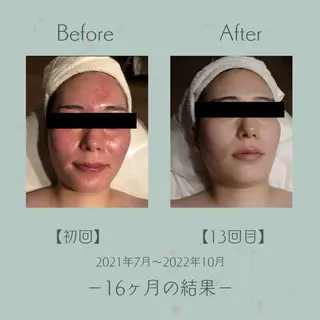 エステツイン広島店 FacialBodyのエステ・リラクイメージ