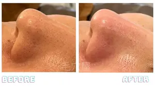 毛穴/毛穴洗浄専門 エミルカ船橋のエステ・リラクイメージ