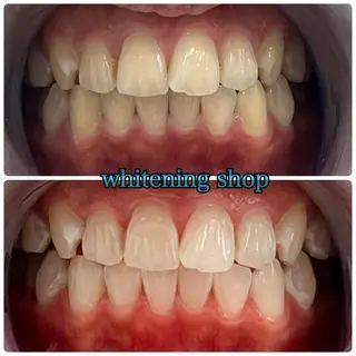 ホワイトニング ショップ千葉店のその他イメージ