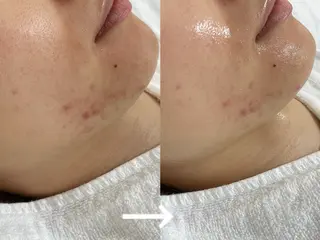 private salon éclat所属・ニキビ・毛穴専門 éclat/エクラのエステ・リラクイメージ