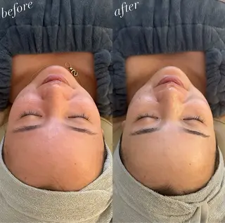 うなじ脱毛/美肌脱毛 LABELのエステ・リラクイメージ