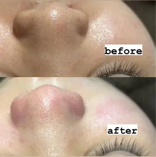 salon de Nのエステ・リラクイメージ