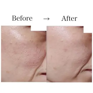 トラブル肌専門店 プレイス天王寺店のエステ・リラクイメージ