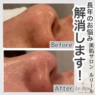 プライベートサロンLe Rire【ルリール】所属・美肌•小顔サロン ルリールのエステ・リラクイメージ