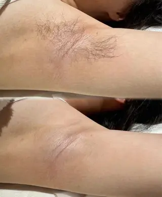 マツエク・マツパ aliaハイフ&水光ジェットサロン所属・aliaハーブ水光店 エステティシャン募集のエステ・リラクイメージ