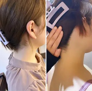 うなじ脱毛/美肌脱毛 LABELのエステ・リラクイメージ