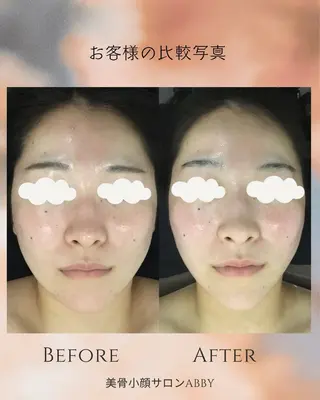小顔コルギ💎 ABBY SANOのエステ・リラクイメージ