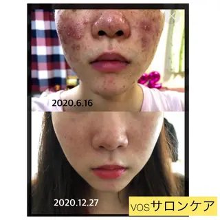 laluna saki...のその他イメージ