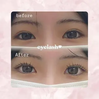 ãããšã¯ã»ããã VIAS rin.âððã®ãããšã¯ã»ããããã¶ã€ã³