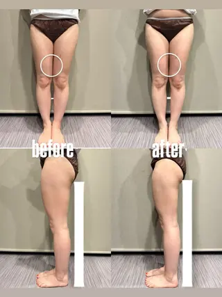 【痩身・脱毛】private salon Eclat所属・伊藤 心のエステ・リラクイメージ