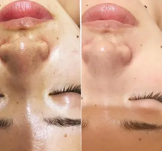 🥀エステティック レイビス横浜 永🥀のエステ・リラクイメージ