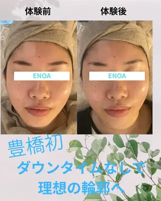 ENOA所属・コルギ/全身リンパ saoriのエステ・リラクイメージ