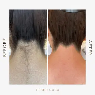 ワックス脱毛🌈 ESPOIRnocoのエステ・リラクイメージ