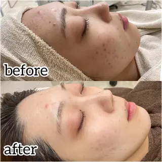 laluna saki...のその他イメージ