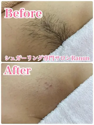 マツエク・マツパ シュガーリング脱毛 専門店Ranunのエステ・リラクイメージ
