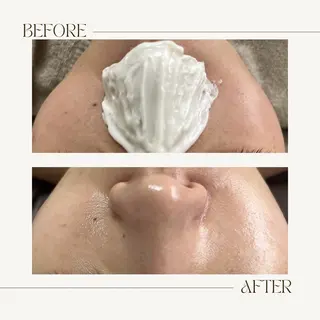 1st｜フェイシャル エステ専門店のエステ・リラクイメージ