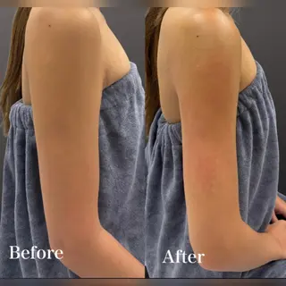 心斎橋🤍堀江.小顔 ハーブ.痩身クレビアのエステ・リラクイメージ