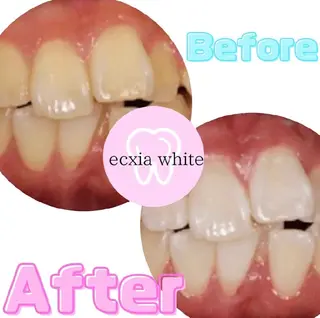 メンズ エクシアホワイトニング草津店所属・nanami -ホワイトニングのその他イメージ