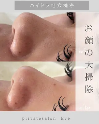 Eve [nail ＊wax＊HBL]のエステ・リラクイメージ