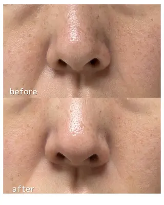 BellaLuna 金子のエステ・リラクイメージ