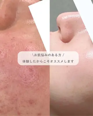 、 、‪‪のエステ・リラクイメージ