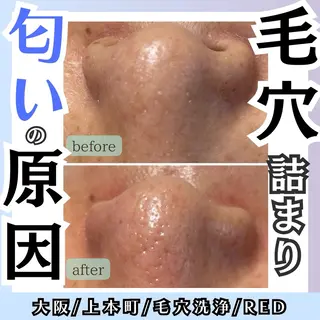 毛穴レス ハーブ＆ ワックス脱毛×光脱毛のエステ・リラクイメージ