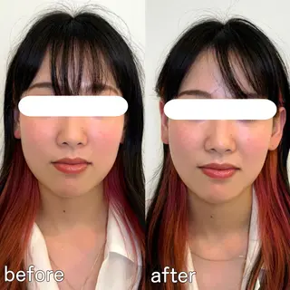 小顔矯正&美容整体 整え屋REDオーナーのエステ・リラクイメージ