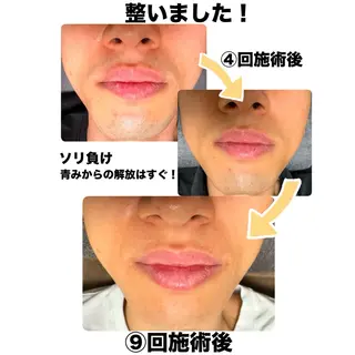 メンズ メンズ脱毛サロン Le falcoのエステ・リラクイメージ