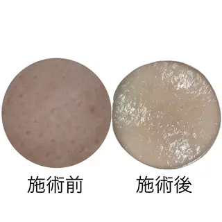 メナードフェイシャルサロン丸の内ヒルズ所属・メナード丸の内ヒルズ 柳田りさのエステ・リラクイメージ