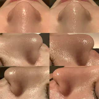 脱毛&エステサロン JIGGLY武蔵小山のエステ・リラクイメージ