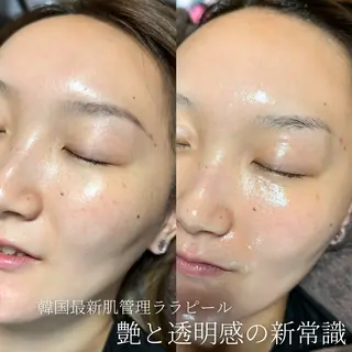 眉と肌の専門店　-STORY-所属・眉と肌の専門店 STORYのエステ・リラクイメージ