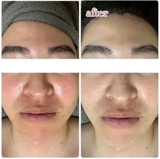 MINOA所属・MINOA 井上🌷のエステ・リラクイメージ