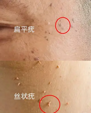 ビューティーリゾート麗所属・于 麗影のエステ・リラクイメージ