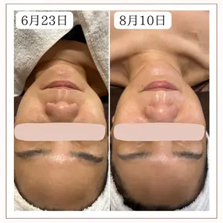 メンズ STELLAR. 谷岡恵里香のエステ・リラクイメージ