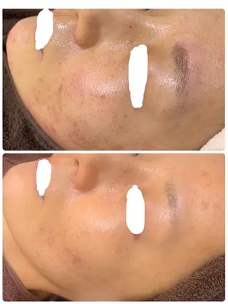 バスト美肌小顔専門 Mimpi【ミンピ】のエステ・リラクイメージ