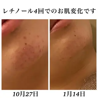 Bellesthe （ベルエステ）のエステ・リラクイメージ