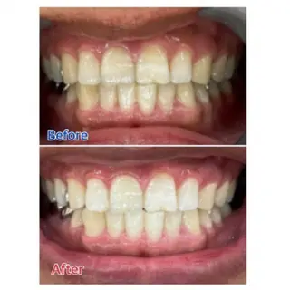 M渋谷店所属・Ｍ渋谷 ホワイトニングのエステ・リラクイメージ