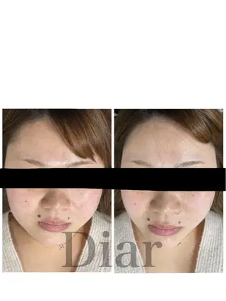 Diar salonのその他イメージ