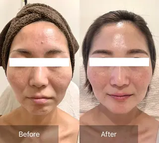 Charis エステ&ネイルのエステ・リラクイメージ