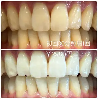 メンズ ホワイトニングルーム　川崎店所属・ホワイトニング ルーム　川崎店のその他イメージ