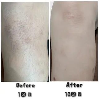 キッズ エスティックサロン Moon-bell所属・エステティクサロン Moon-bellのエステ・リラクイメージ