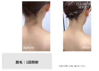 【痩身・脱毛】private salon Eclat所属・伊藤 心のエステ・リラクイメージ