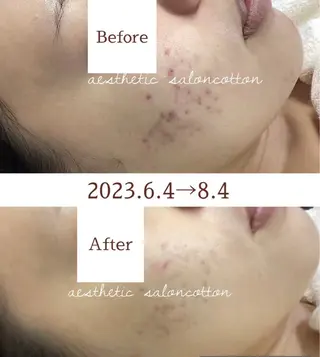 都度払い 肌質改善専門サロンのエステ・リラクイメージ